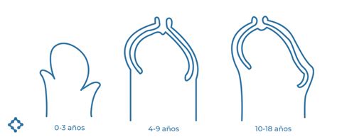 Recuperación tras Fimosis, antes y después